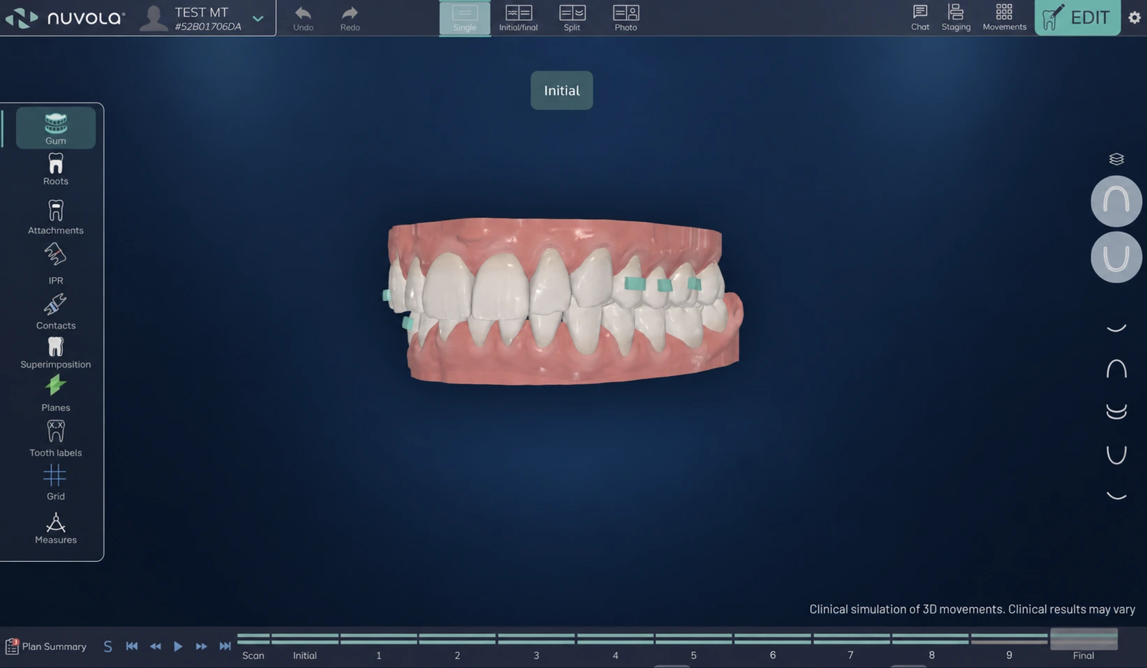 Anteprima dell'interfaccia Giotto 2.0 tratta dalla presentazione Nuvola